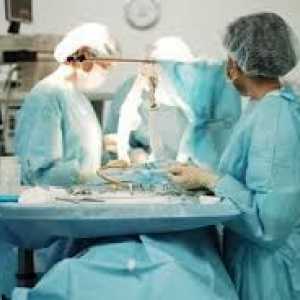 Operacija kroničnog pankreatitisa, kirurgija