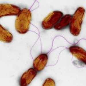 Infekcije uzrokovane Vibrio cholerae nije