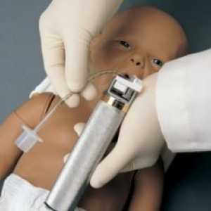 Neonatalna intubacija: cijevi Tehnologija intubacija