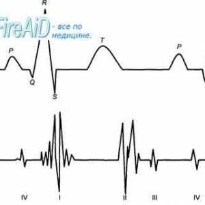 Srce zvuči. Prvi (sistolički) srce zvuk. Drugi (dijastolički) srce zvuk. Phonocardiogram.