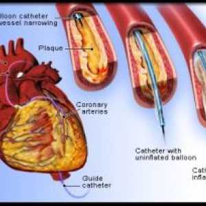 Studija arterije