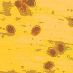 Roundworm jaja u ljudskim izmetom (foto) kao što izgleda, način prijenosa Ascariasis odrasle i djecu