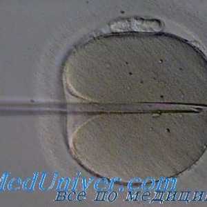 In vitro oplodnja (IVF), Mogućnosti i perspektive