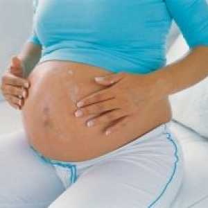 Jod tijekom trudnoće, mogu koristiti?