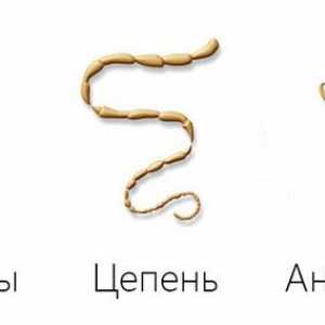 Kako su crvi u ljudi, je li moguće vidjeti golim okom cheloveeskih crva?