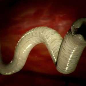 Koje su dimenzije crva (helminta) u ljudi?