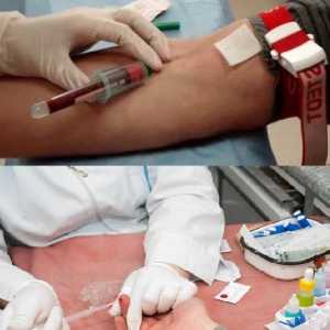Što je krvni test određuje crva u dijete i odrasla osoba, opći, IFA iz vene?
