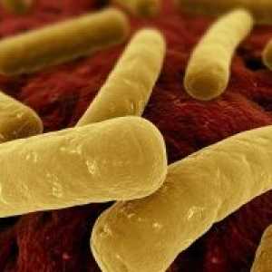 Bakterijskih nekrotizirajući enteritis