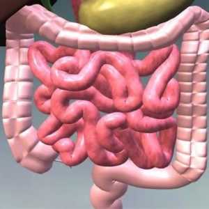Kolonoptoz crijeva prolaps u poprečno debelo crijevo