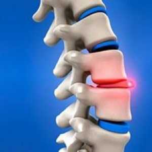 Konzervativno liječenje leđa: učinci na koštanog sustava
