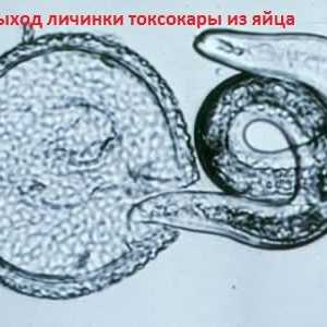 Ličinke i jaja Toxocara visceralni toxocariasis