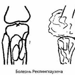 Zračenje i instrumentalni dijagnoza zgloba koljena patologije. artritis