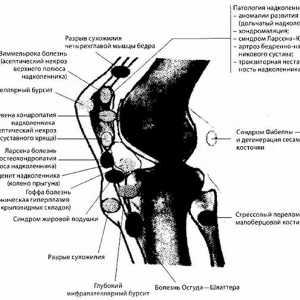 Zračenje i instrumentalni dijagnoza zgloba koljena patologije