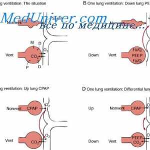 Maksimalna dobrovoljno ventilacija tijekom vježbanja. Aerobna izdržljivost tijekom vježbanja