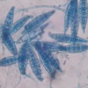 Microsporidiosis kod ljudi: simptoma, liječenje
