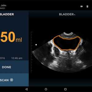 Minijaturni ultrazvuk skener za urologa
