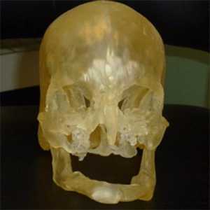 Model za transplantaciju lica može se ispisati na 3D-pisač
