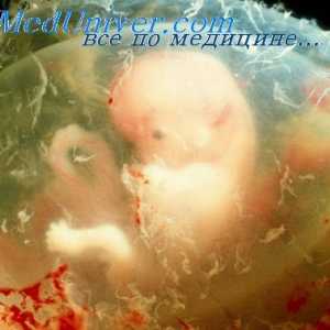 Mišićje međice fetus. Morfologije embrija glavu i vratne mišiće