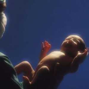 Ne-infektivnih bolesti kože, tkiva, supkutano i umbilikalne pupčane rana ravnoteža u novorođenčadi