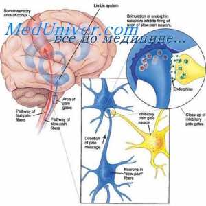 Neuroblastoma djece. Razvoj neuroblastoma u djece
