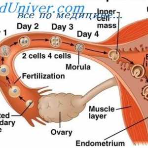 Nenormalan mjesto implantacija embrija. Jajnika i trbuhu trudnoća