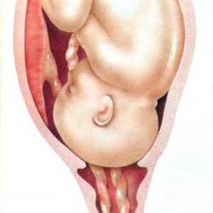 Netolerancija rođenja: pad srca fetusa aktivnosti, gubitak i kompresije pupkovine