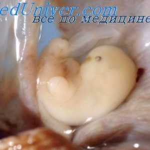Polie noge fetalnog mozga. Fetalni razvoj epithalamus