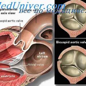 Obrazovanje aorte ventila. Odvajanje fetusa arterijske prtljažniku