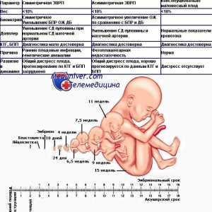 Utvrđivanje rođenja pobačaja. Klasifikacija fetalnog usporavanja rasta