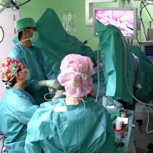 Operacija za uklanjanje crijeva diverticula
