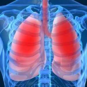 Tumori dišnih puteva: liječenje, simptoma, dijagnoza