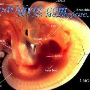 Osobitosti dijagnostici fetalnih sindroma. Ahondrogenez i njegova frekvencija