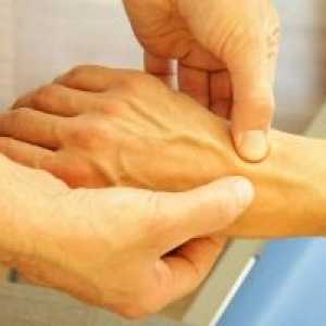 Osteoartritis zglob: liječenje, uzroci, simptomi, znakovi