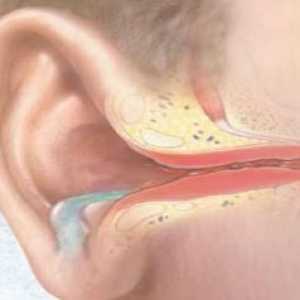 Akutnim gnojnim upala srednjeg uha: liječenje, simptomi, znakovi, uzroci