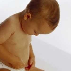 Ingvinalne hernije u dijete