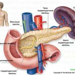 Pankreatitis liječenje, simptomi, uzroci