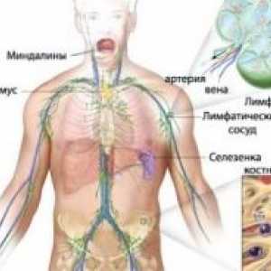 Primarni limfom centralnog nervnog sustava