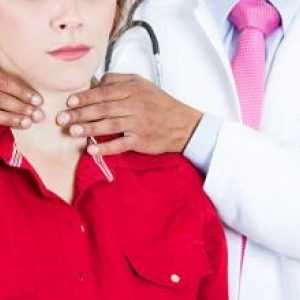 Subakutni tiroiditis štitnjače: liječenje, simptoma, učinaka, dijagnoze