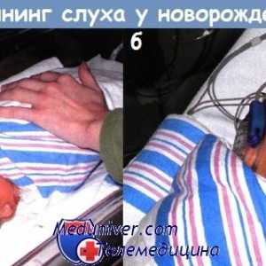 Oprema za ispitivanje sluha u novorođenčadi