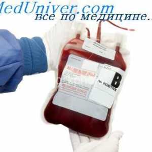 Indikacije i kontraindikacije za transfuziju crvenih krvnih stanica u novorođenčadi