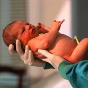 Malformacija kod novorođenčadi