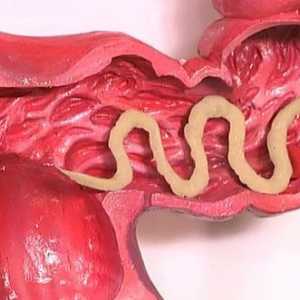 Povećava apetit u crva (helminta)