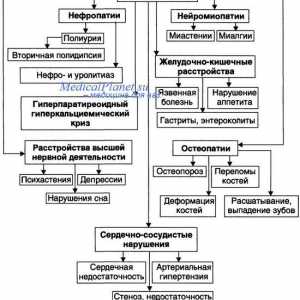 Hiperparatireoidizam i osteodistrofija paratirioidnaya. Fibrocystic upala kostiju i von…