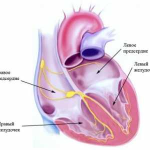 Srčani sustav provođenja