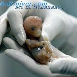 Putevi embrij. Formiranje vodljivih staza fetusa