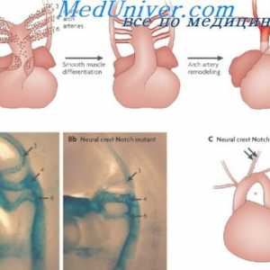 Razvoj arterijski krvožilni sustav. Stupnjevi formiranja fetusa aortu