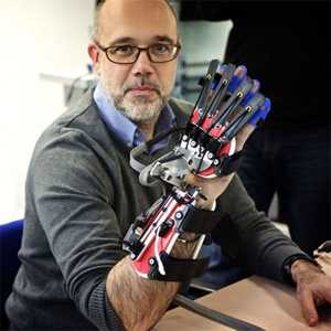Robotski rukavice za moždani udar rehabilitaciju