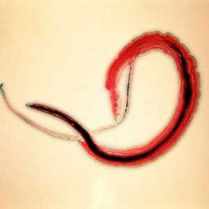 Bilharzia (shistosomijaza, bilharzia), uzročnik krvi (Japan) trematode