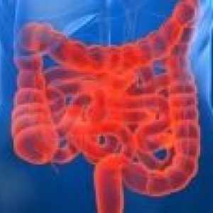 Sindrom kratkog crijeva: liječenje, simptomi