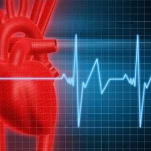 Sinus tahikardija srca: liječenje, simptomi, uzroci, simptomi
